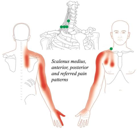 TOS-referral-pattern (1)